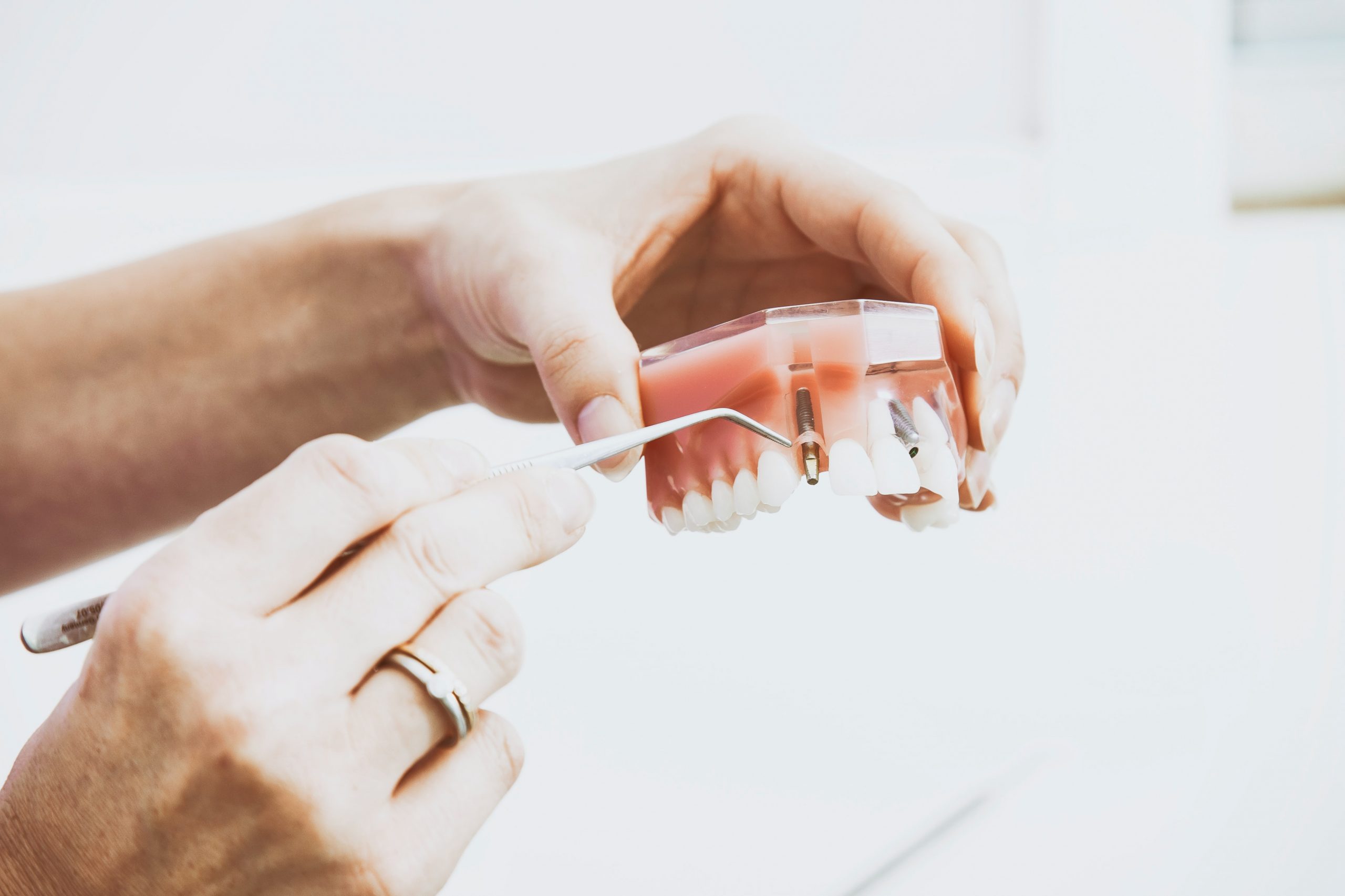 veterans dental implants
